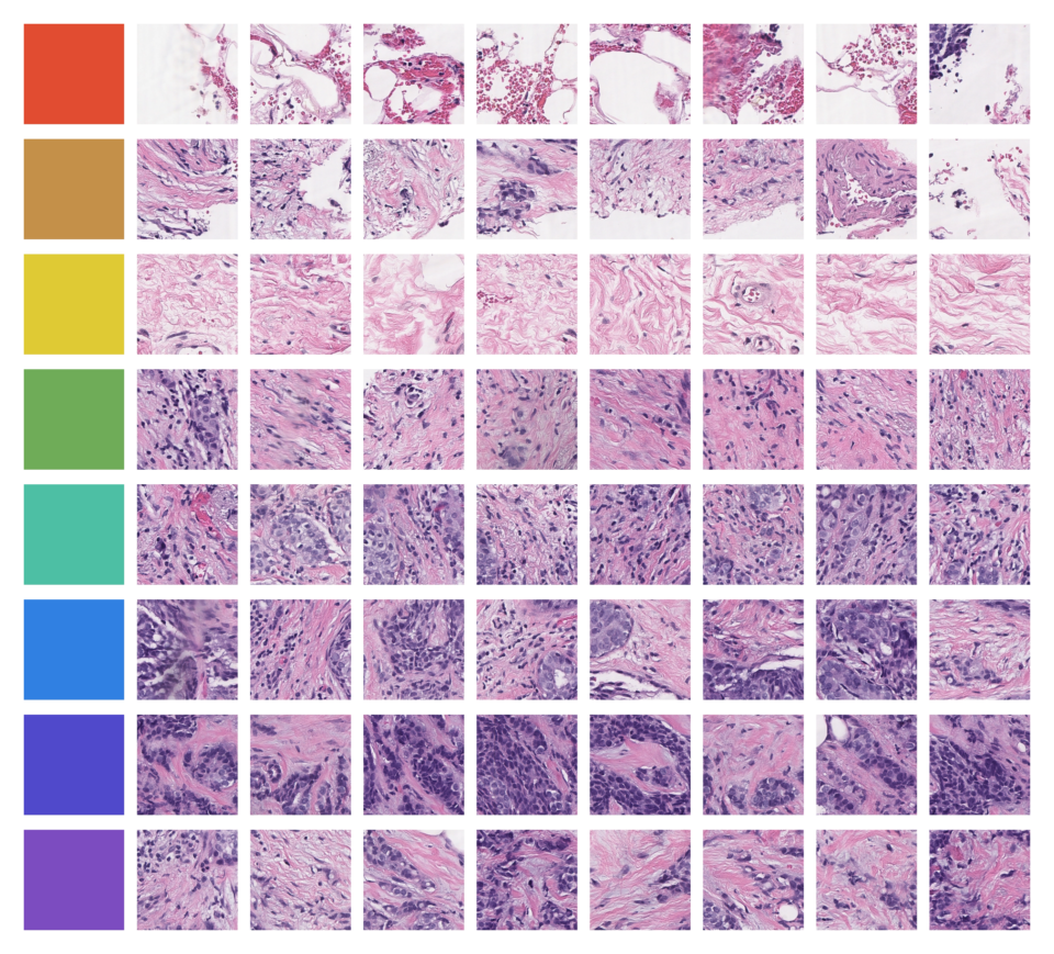 Modelos de Ataraxis interpretando patrones en laminillas de patología